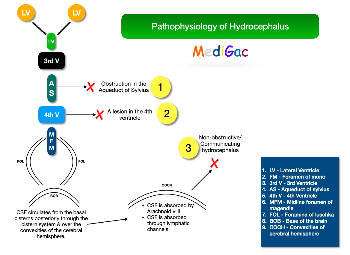 Hydrocephalus pathophysiology